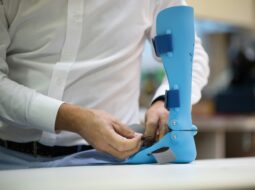 Evolution of orthopedic techniques